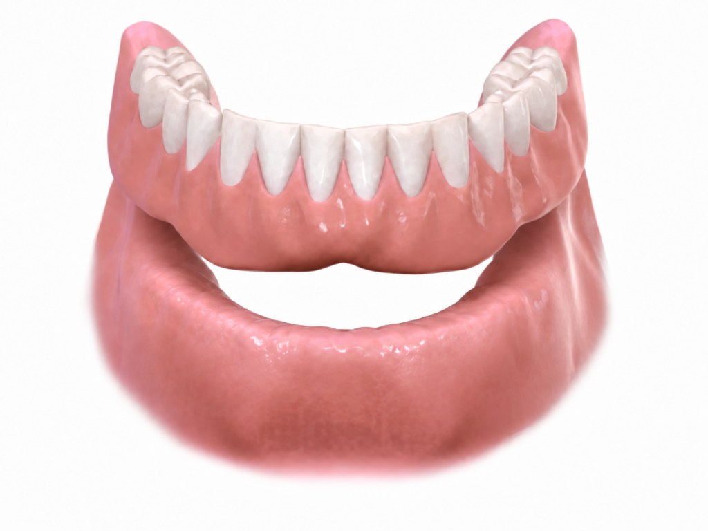 Full upper and lower dentures resting on the gum ridges